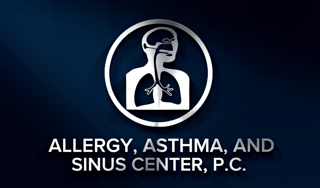 Hypersensitivity bronchial asthma Sinus middle Des Moines